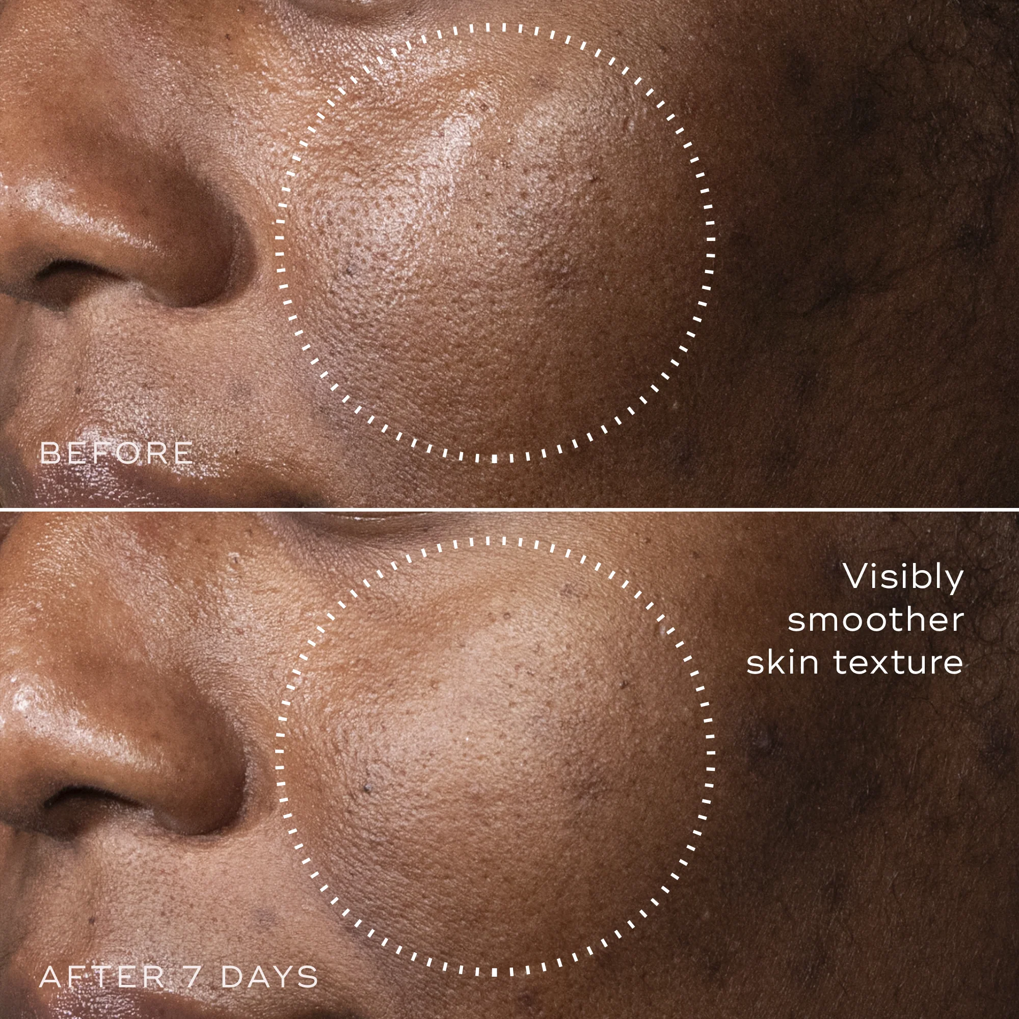 C-Tetra™ Advanced Gel-Serum - Image 4