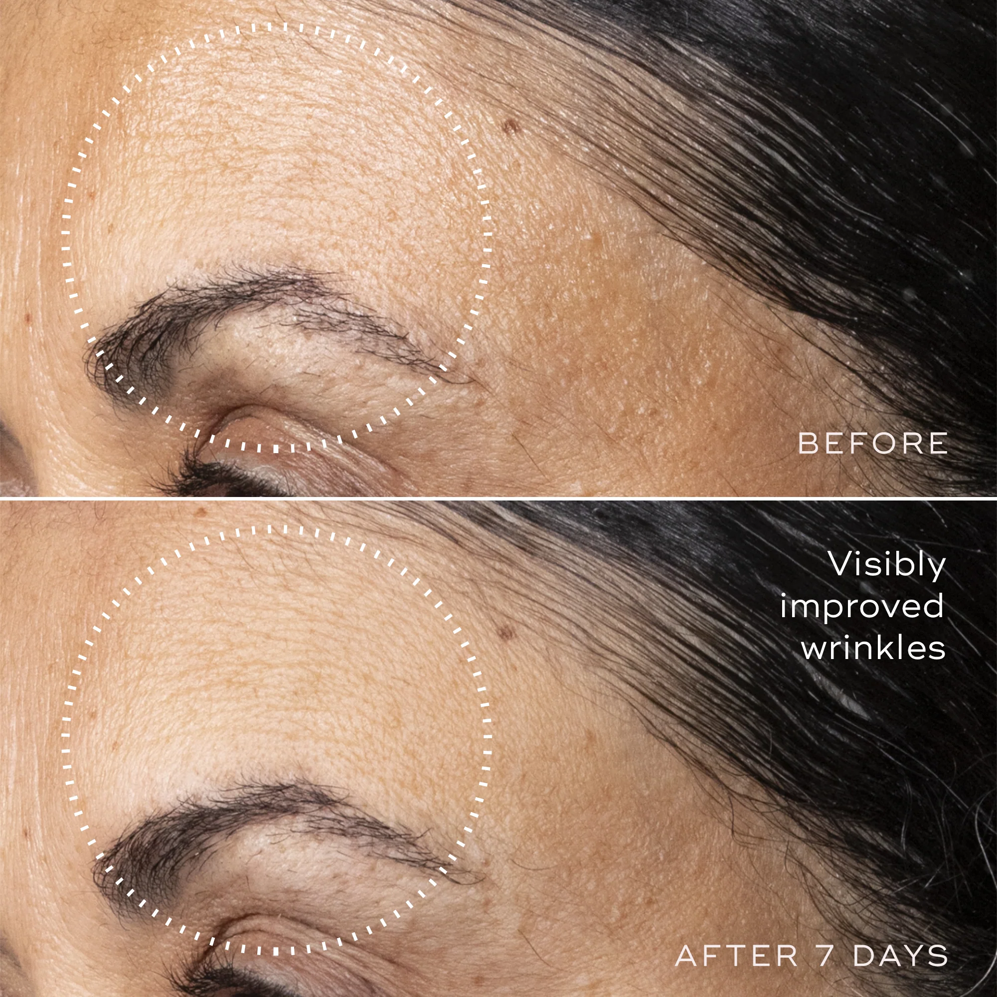 C-Tetra™ Advanced Gel-Serum - Image 5