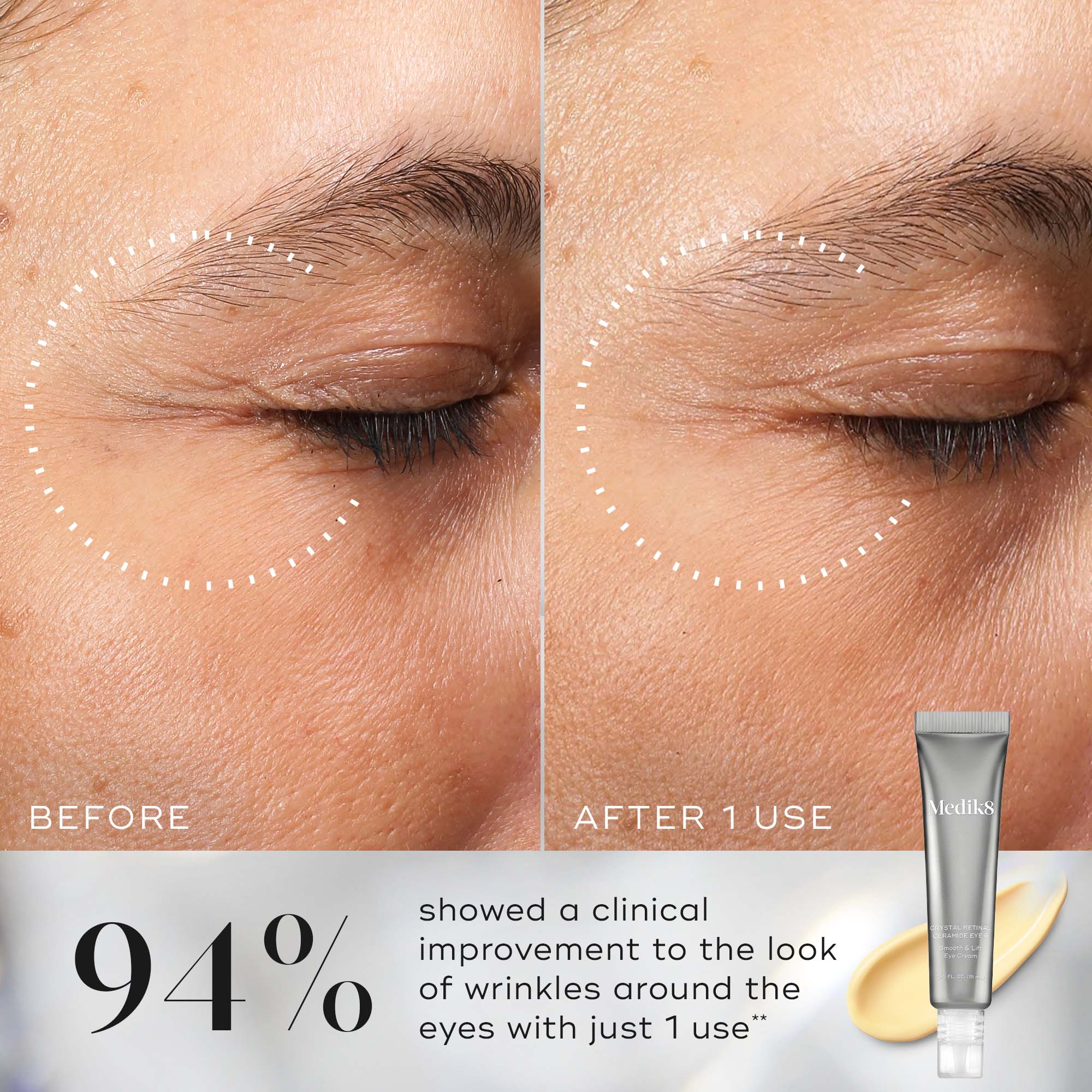 Crystal Retinal® Ceramide Eye - Image 3