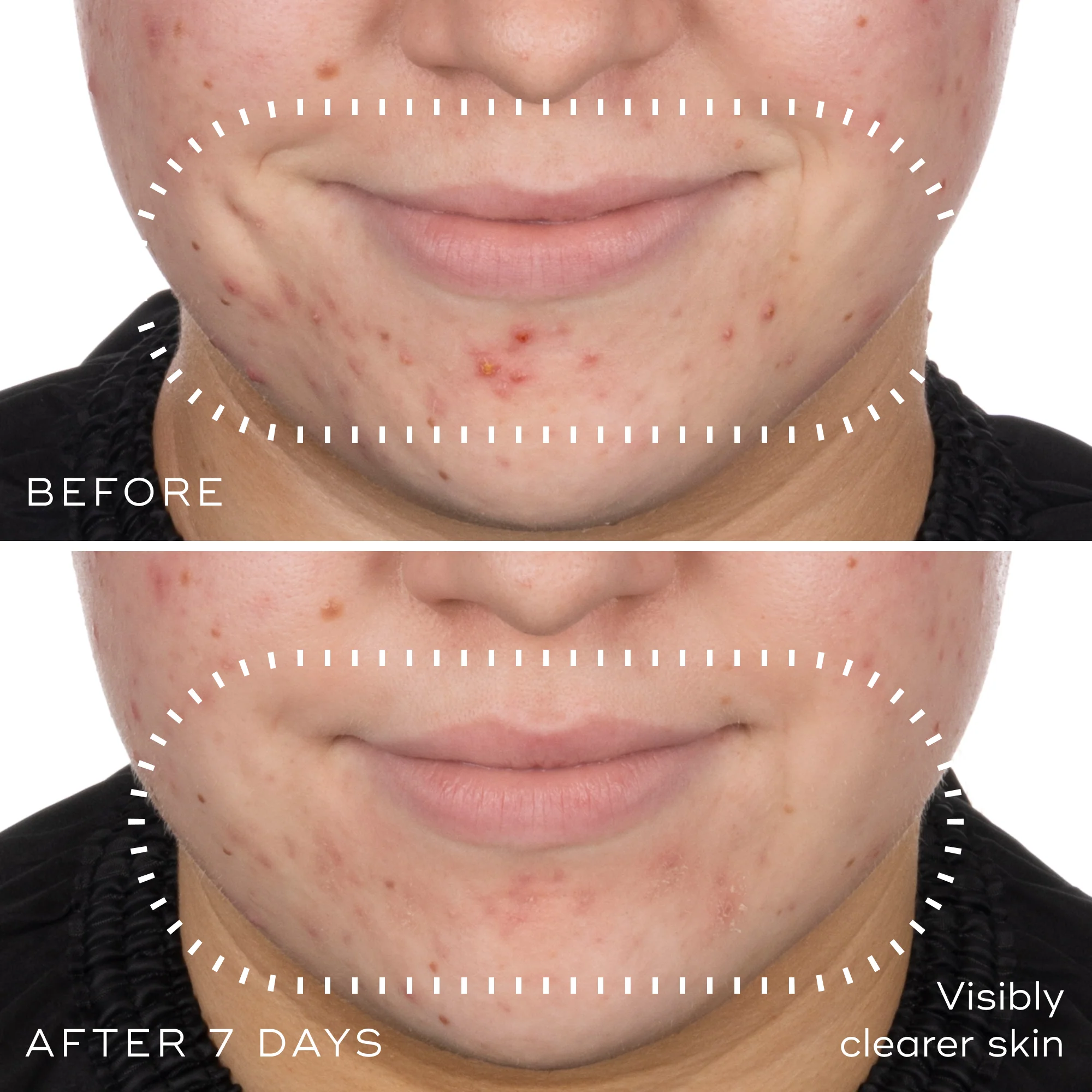 Niacinamide Peptides - Image 3