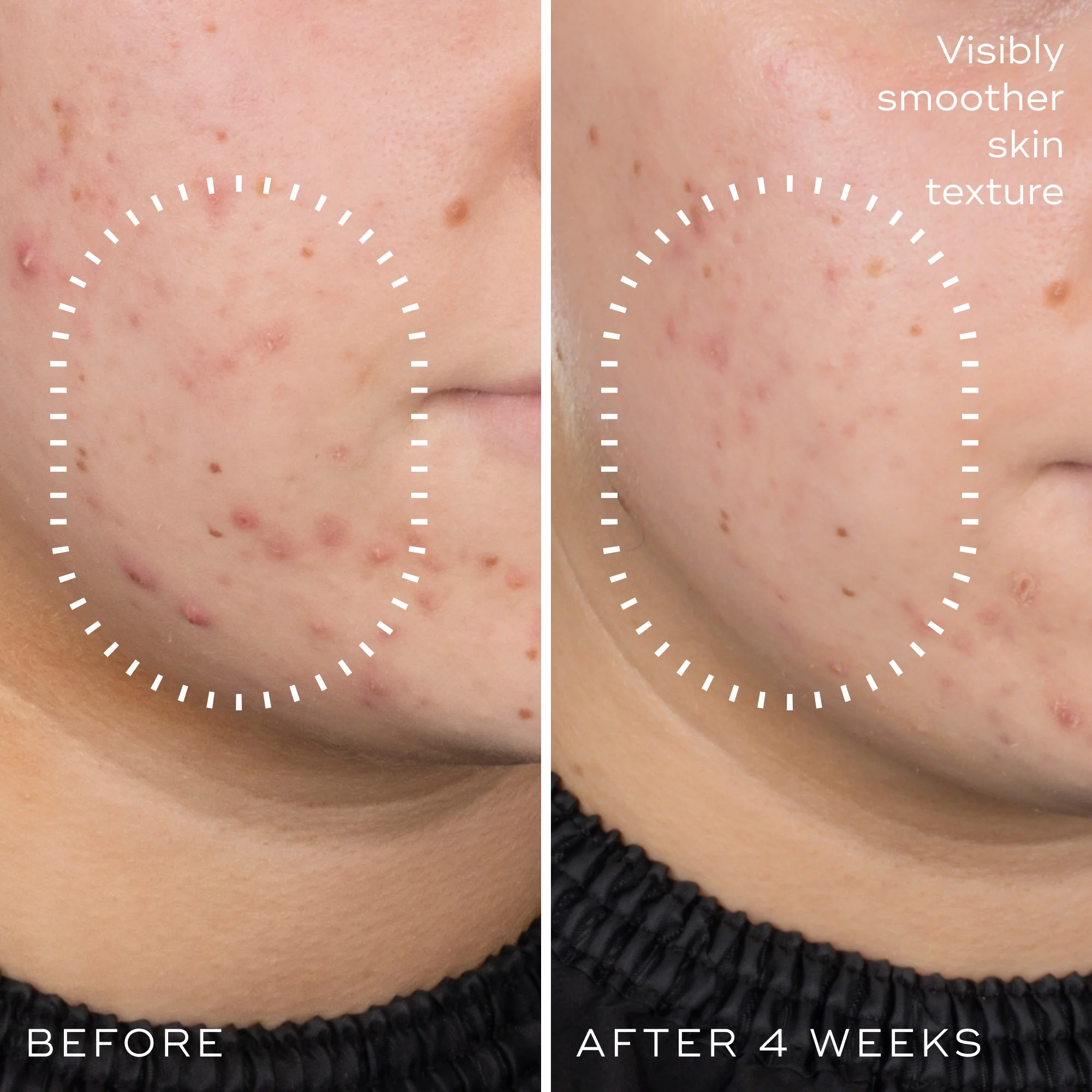 Niacinamide Peptides - Image 4