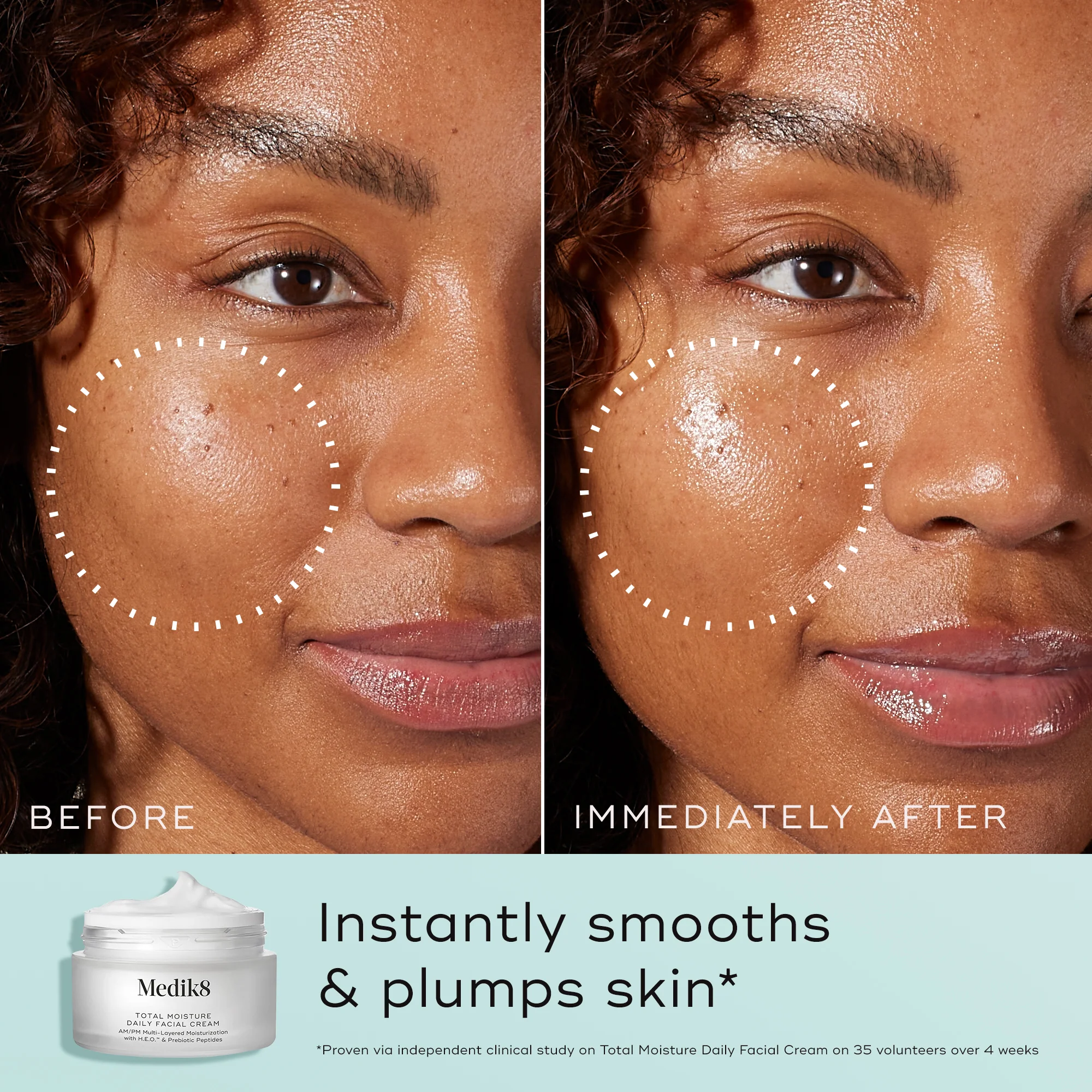 Total Moisture Daily Facial Cream - Image 3